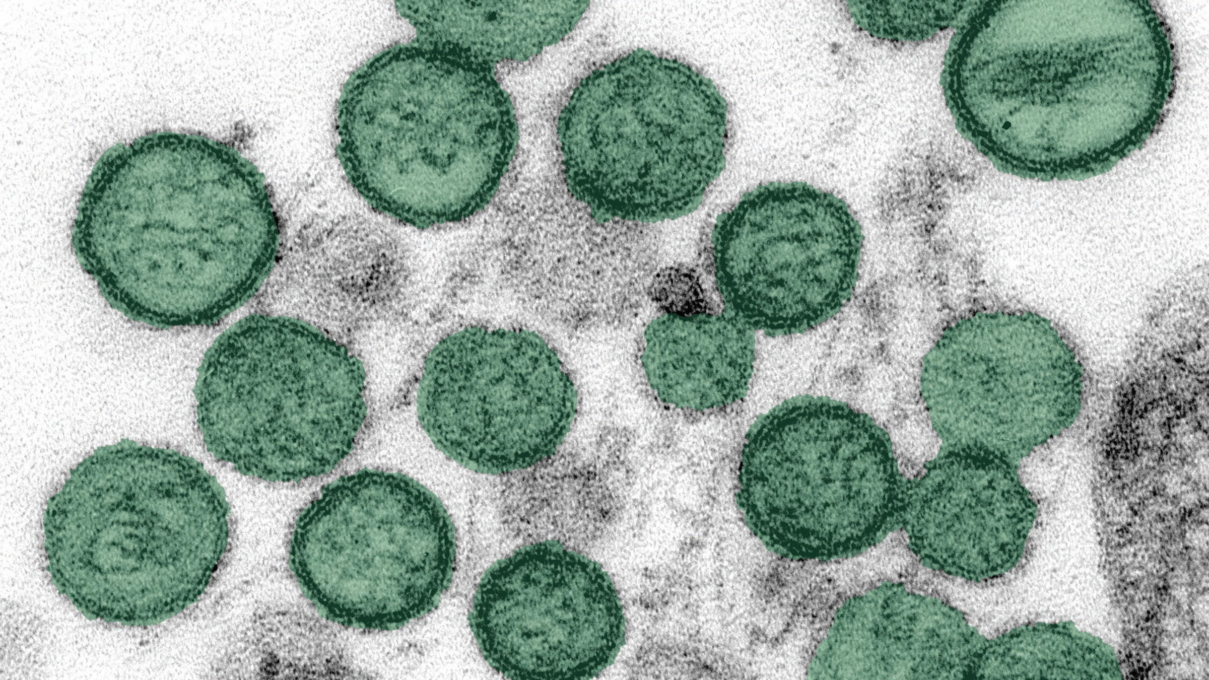 Hantavirus Microscopic Image adapted from cdc.gov image